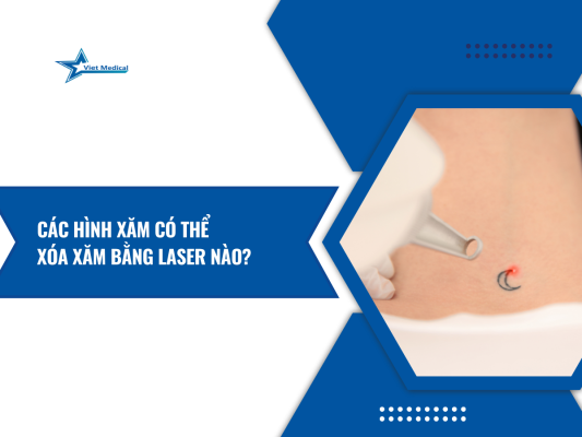 cac-hinh-xam-co-the-xoa-xam-bang-laser-nao