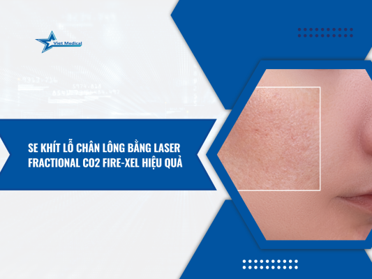 se-khit-lo-chan-long-bang-laser-fractional-co2-fire-xel-hieu-qua-vuot-troi