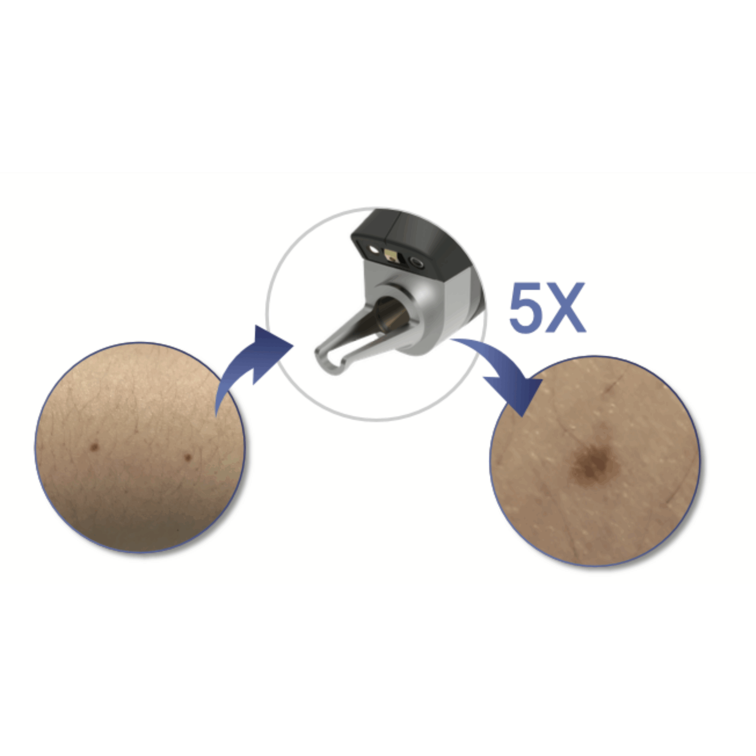 dual-accento-laser (9)